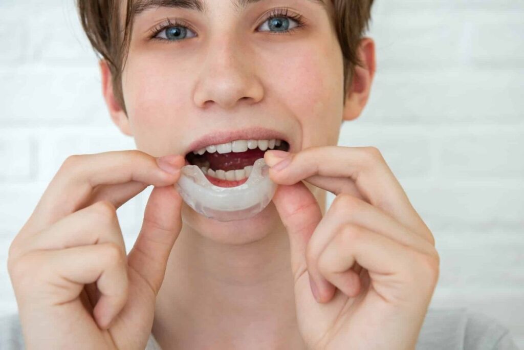 The Importance of Mouthguards for Athletes: Protecting Your Smile and Performance
