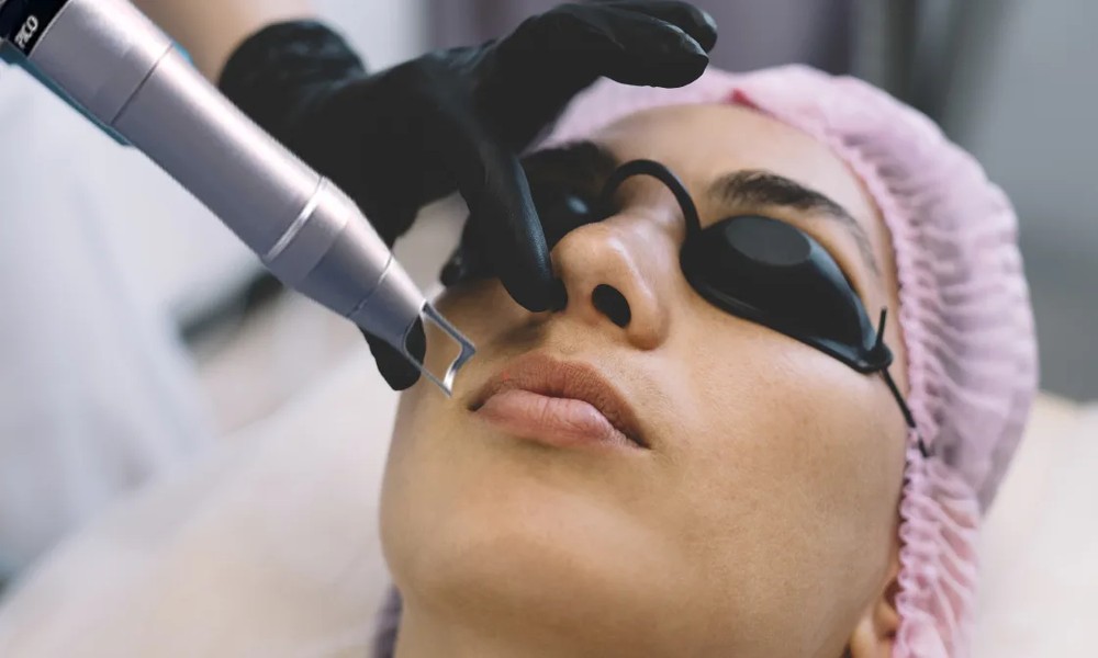Brighter Appearance Outcomes: Picosecond Technology and Modern Skin Enhancement
