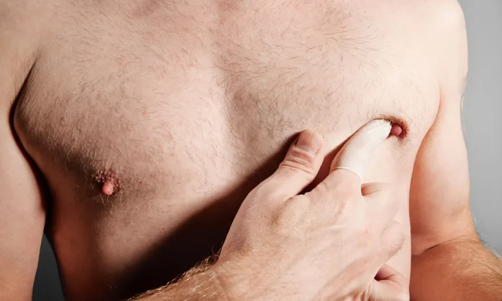Understanding Male Breast Cancer: Symptoms, Risk Factors, and Awareness