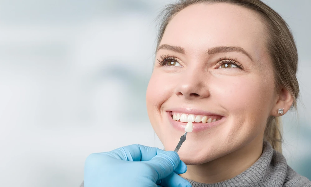 4 Signs It’s Time To Consider Cosmetic Dental Improvements